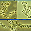 MICROBIOLOGÍA
